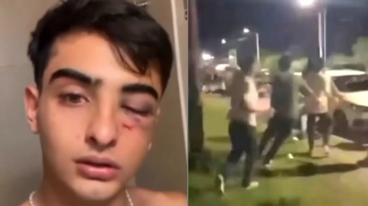 o_b1a87cd0965bf0d39c7524a20b749fc5